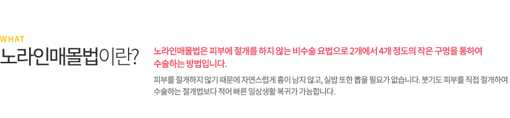 매몰법이란? 매몰법은 피부에 절개를 하지 않는 비수술 요법으로 2개에서 4개 정도의 작은 구멍을 통하여 수술하는 방법입니다. 피부를 절개하지 않기 때문에 자연스럽게 흉이 남지 않고, 실밥 또한 뽑을 필요가 없습니다. 붓기도 피부를 직접 절개하여 수술하는 절개법보다 적어 빠른 일상생활 복귀가 가능합니다.